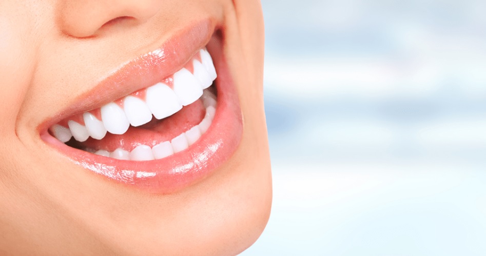 Brightening Smiles: The Art And Science Of Teeth Whitening in Parramatta